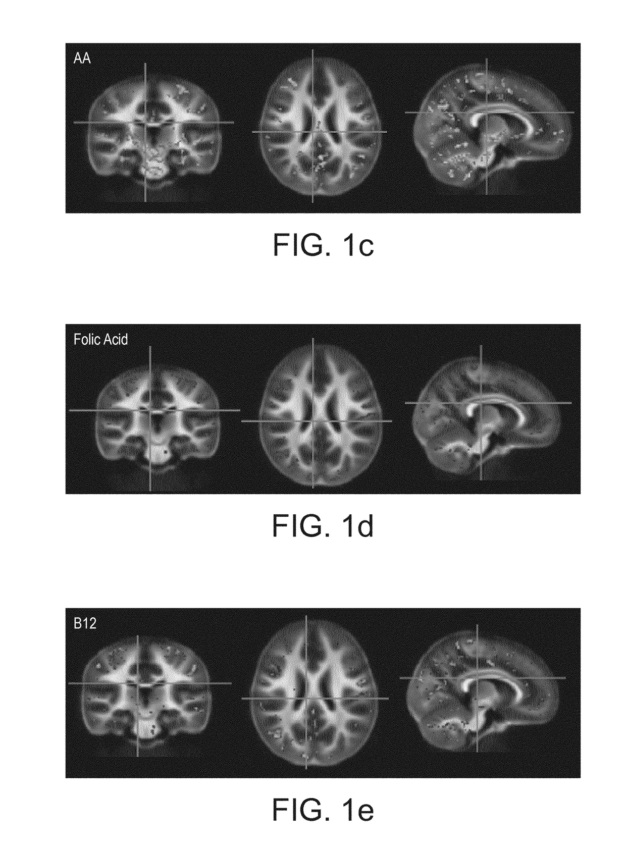 Nutritional composition and infant formula for promoting myelination of the brain