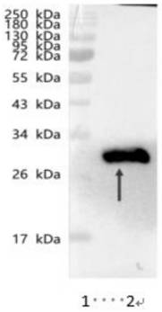Truncated body based on novel coronavirus RBD-SD1 protein and application of truncated body