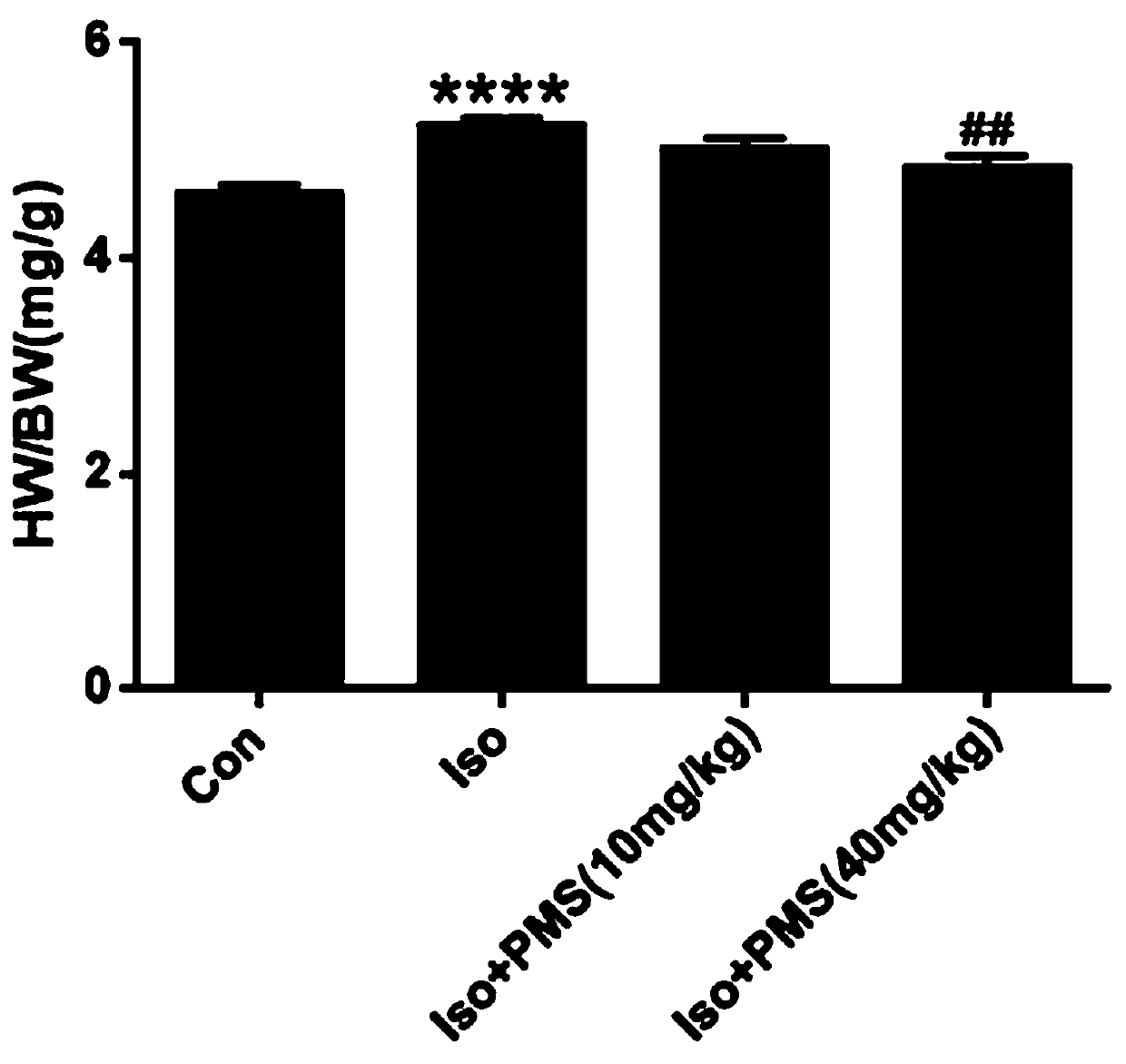 Application of psyllogen in preparation of anti-cardiac hypertrophy drug