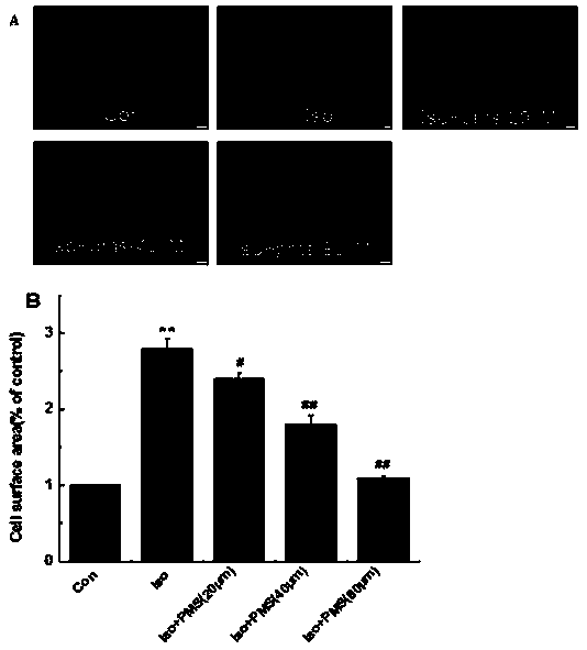 Application of psyllogen in preparation of anti-cardiac hypertrophy drug