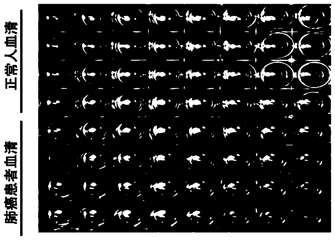 A kind of antibody combination and kit for quantitatively detecting serum lrpprc