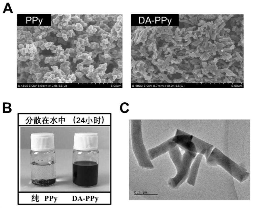 Adhesive conductive-injectable combined hydrogel, preparation method and application thereof