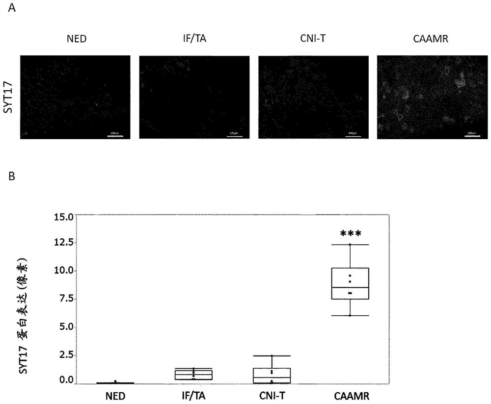 Method for evaluating likelihood of onset or progression of transplanted kidney chronic rejection and chronic kidney disease, test kit, and pharmaceutical composition