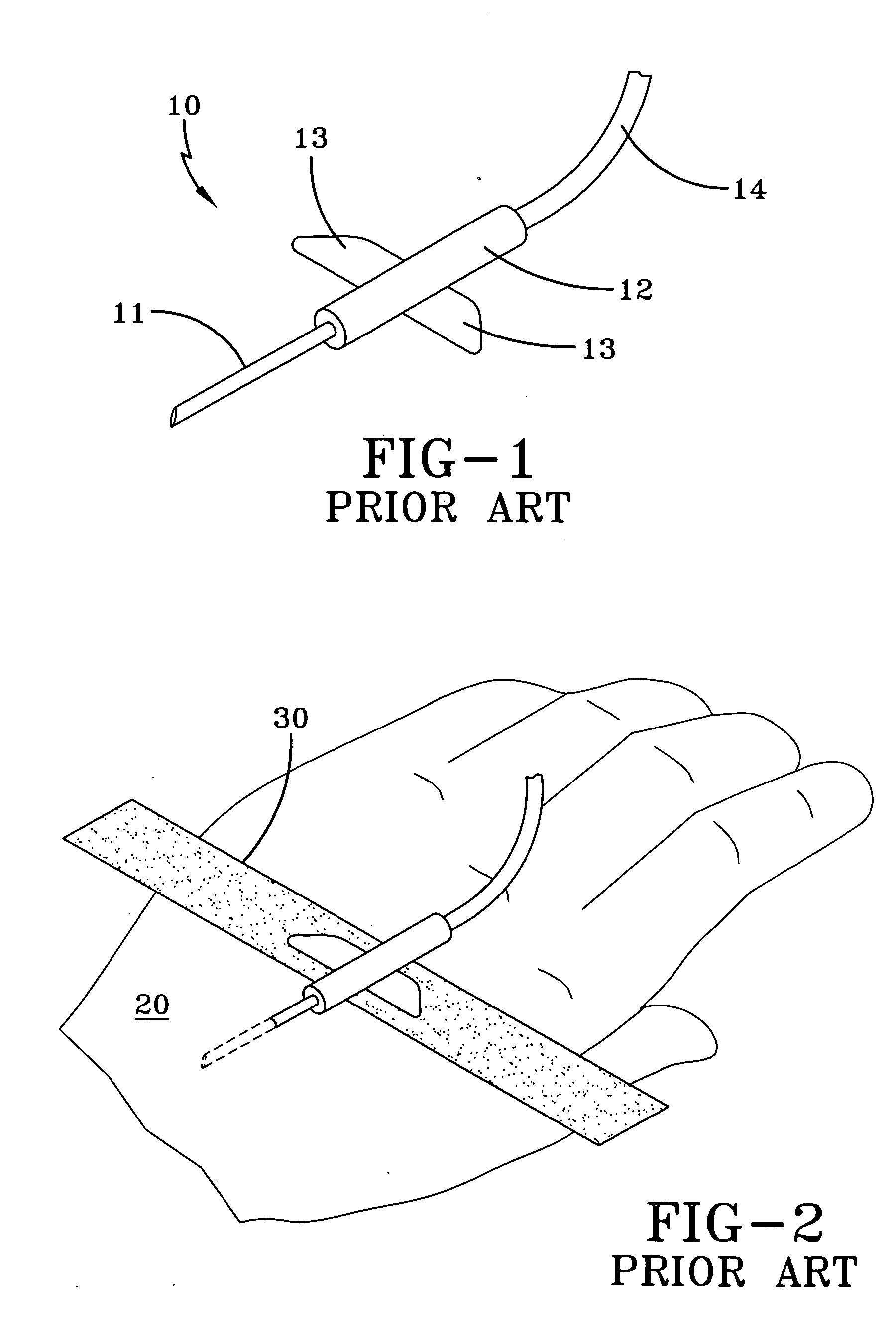 Adhesive tape for an intravascular catheter
