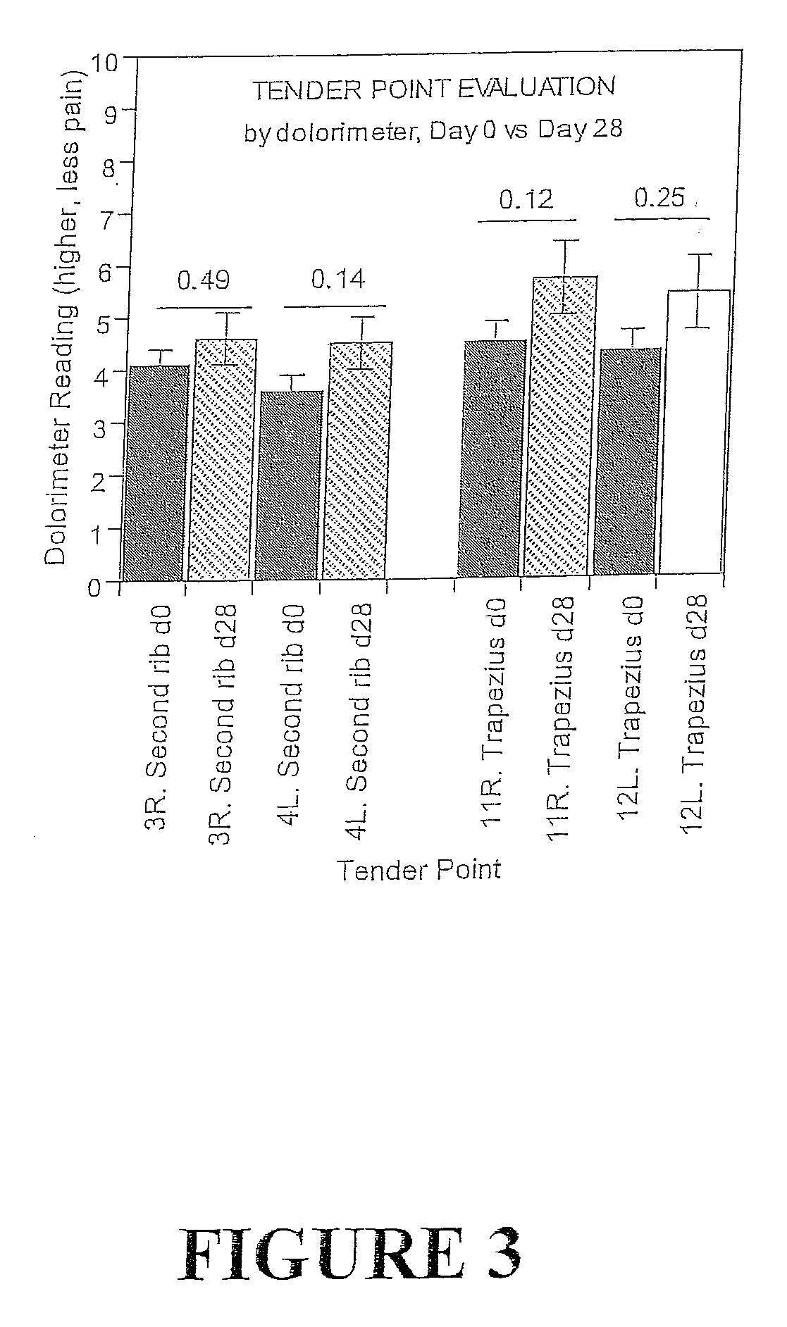 Compositions and methods for treatment of muscle pain and muscle wasting