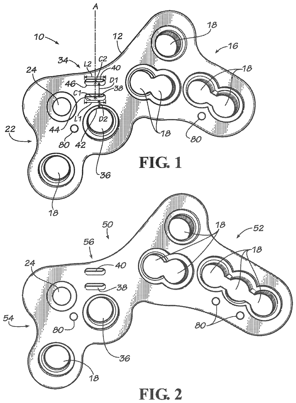 Calcaneal bone plate targeting guide