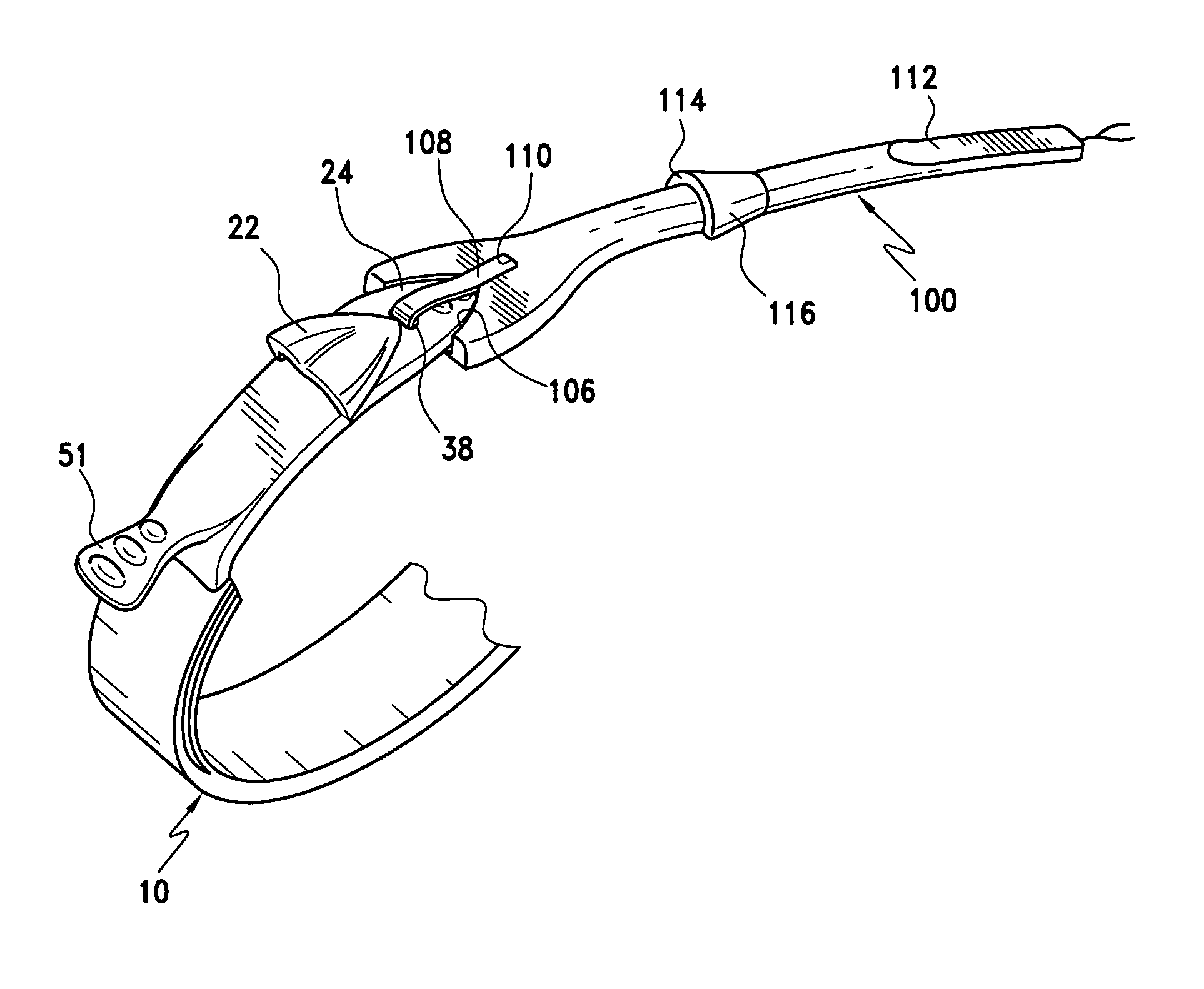 Method of implating a medical device using a suture tab extender