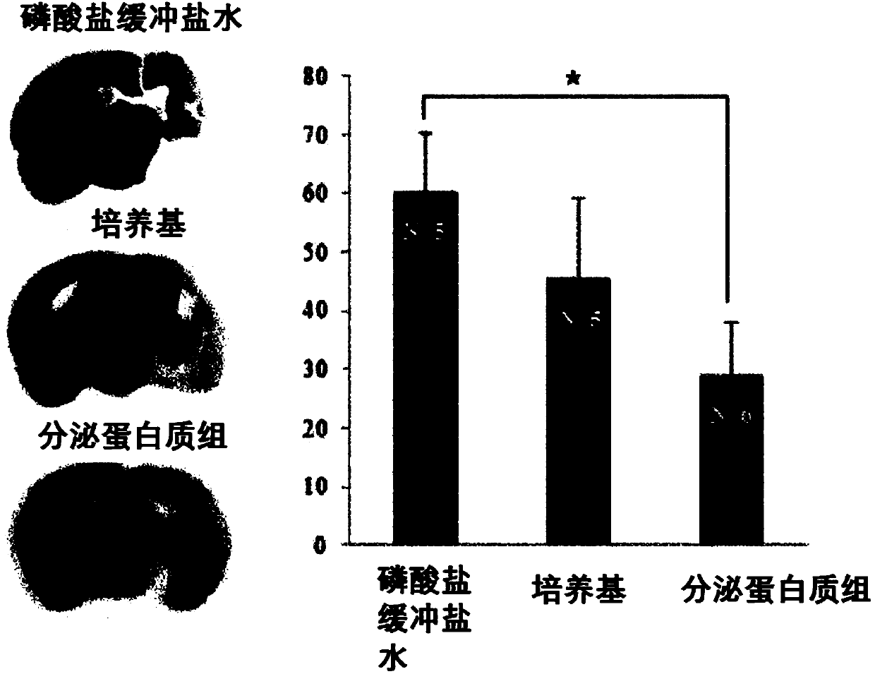 Composition for treating ischemic diseases or neurogenic inflammatory disorders, containing secretome of neural progenitor cells as active ingredient