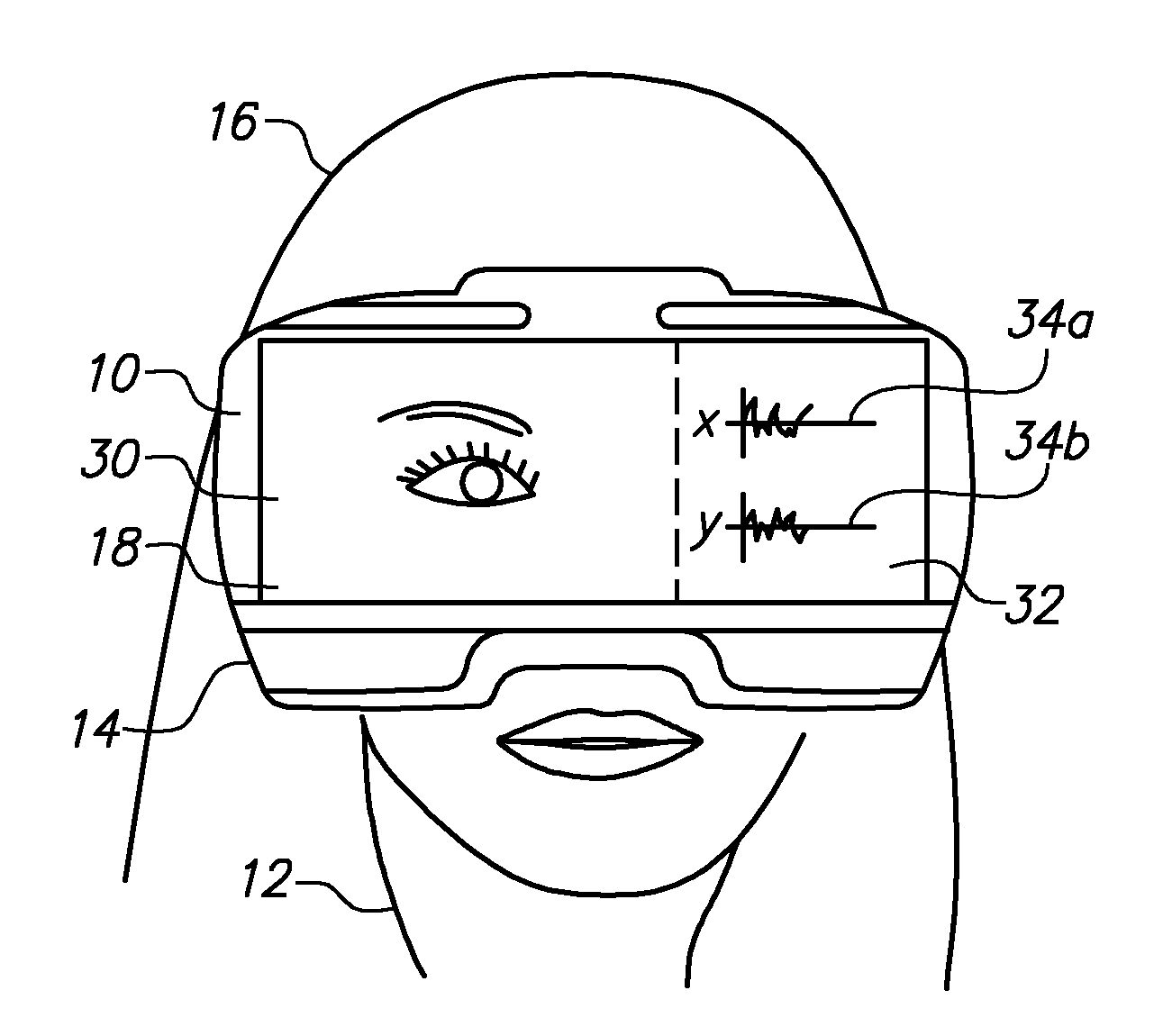 Goggles for emergency diagnosis of balance disorders