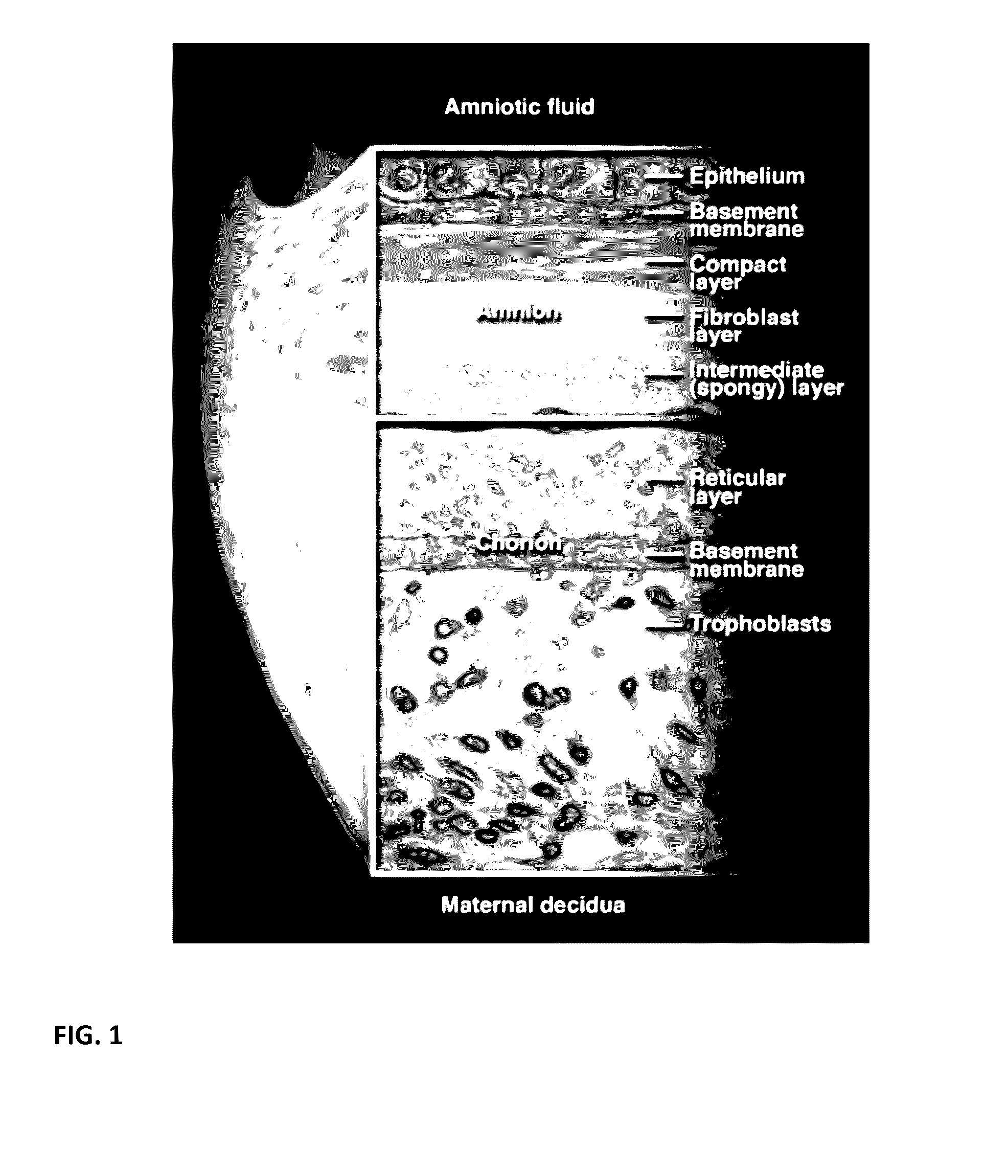 Acellular biologic composition and method of manufacture
