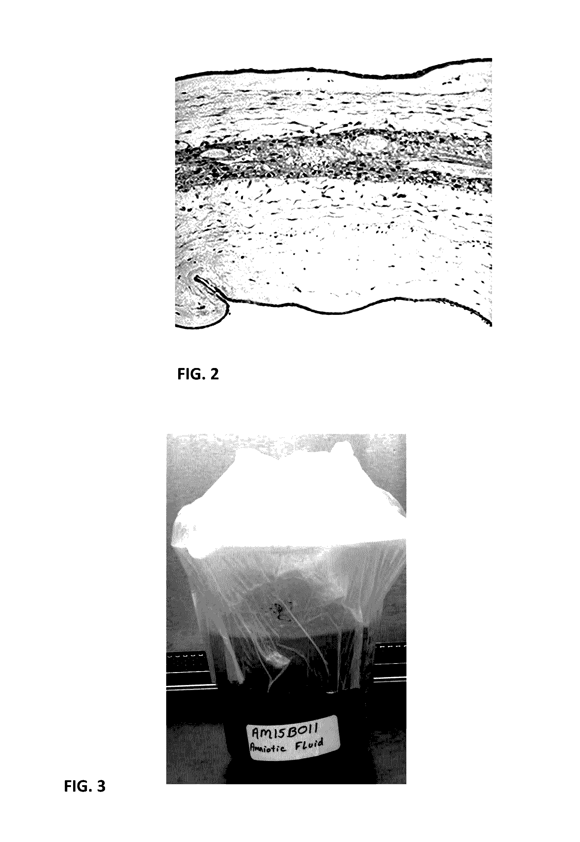 Acellular biologic composition and method of manufacture