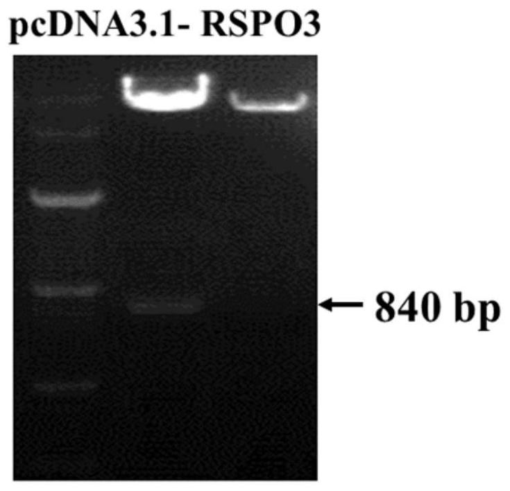 Application of rspo3 gene in sow ovary granulosa cells