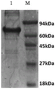 Toxoplasma gondii tandem multi-epitope gene ELISA detection kit