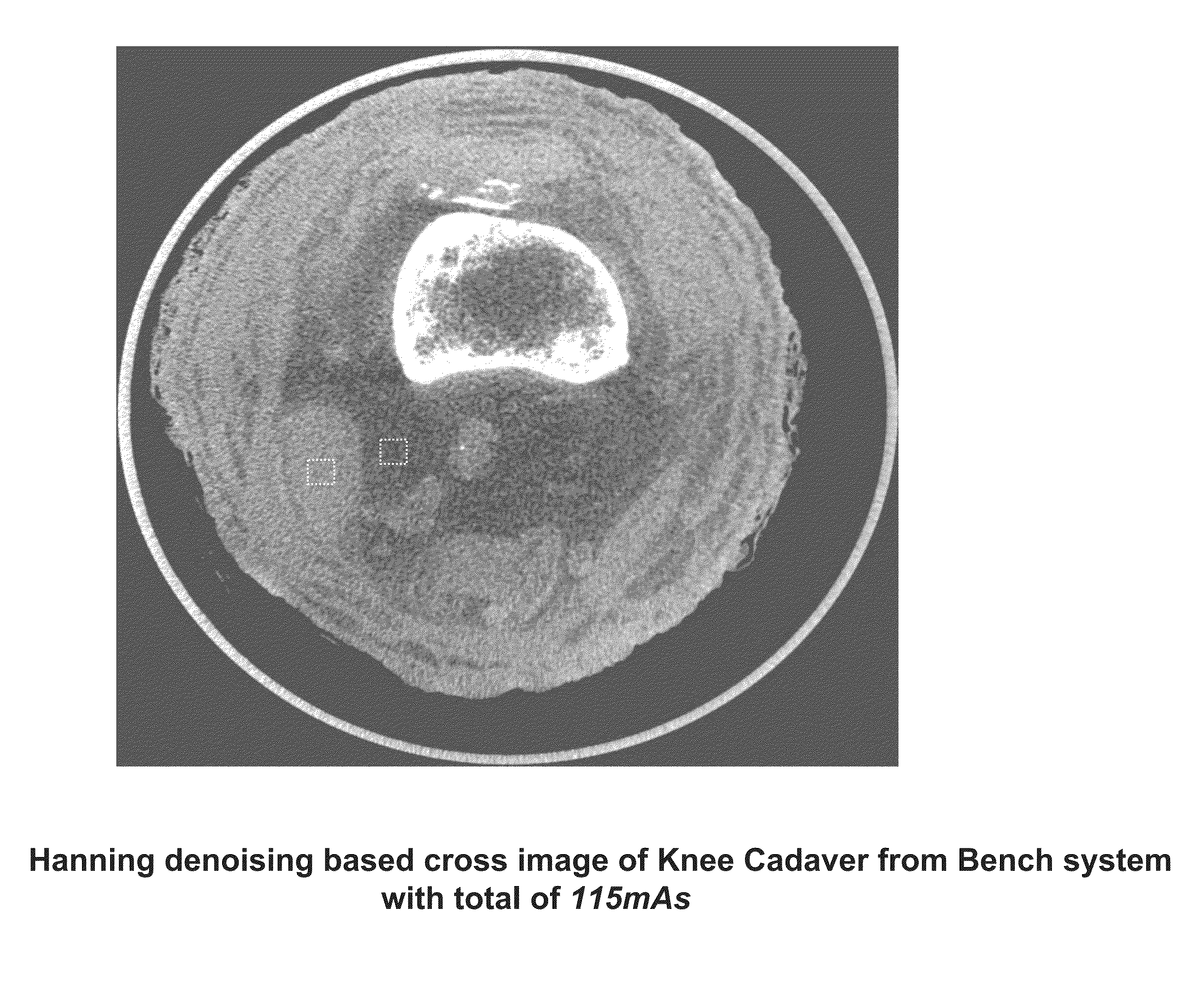 Methods and apparatus for texture based filter fusion for cbct system and cone-beam image reconstruction