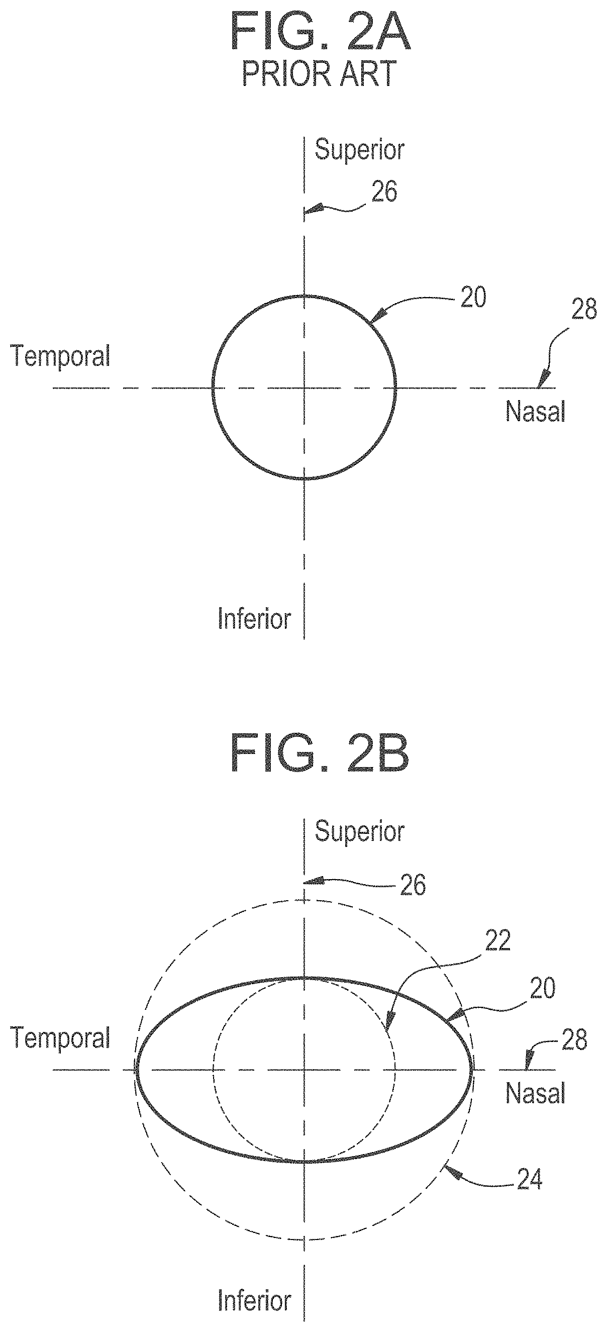 Rotationally stabilized contact lens with improved comfort and improved stabilization utilizing optimized stiffness profiles