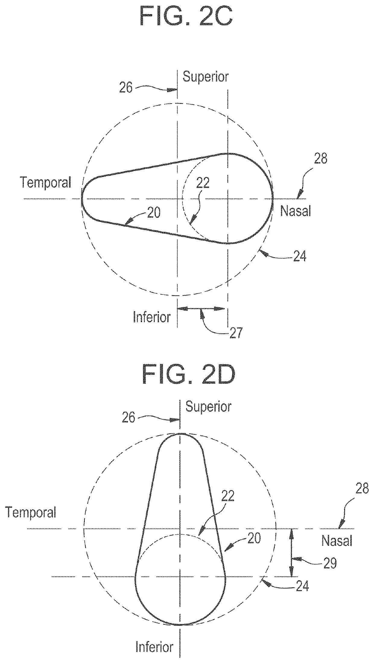 Rotationally stabilized contact lens with improved comfort and improved stabilization utilizing optimized stiffness profiles