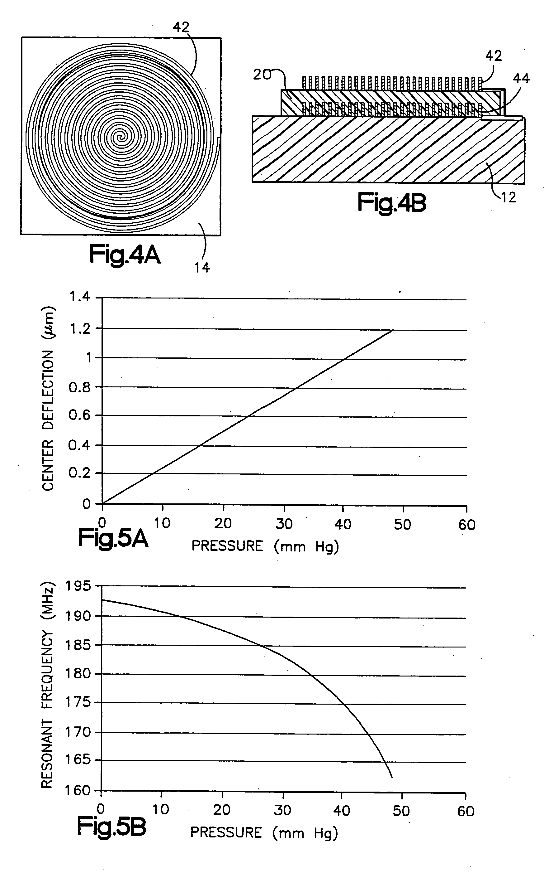 Intraocular pressure measurement system including a sensor mounted in a contact lens