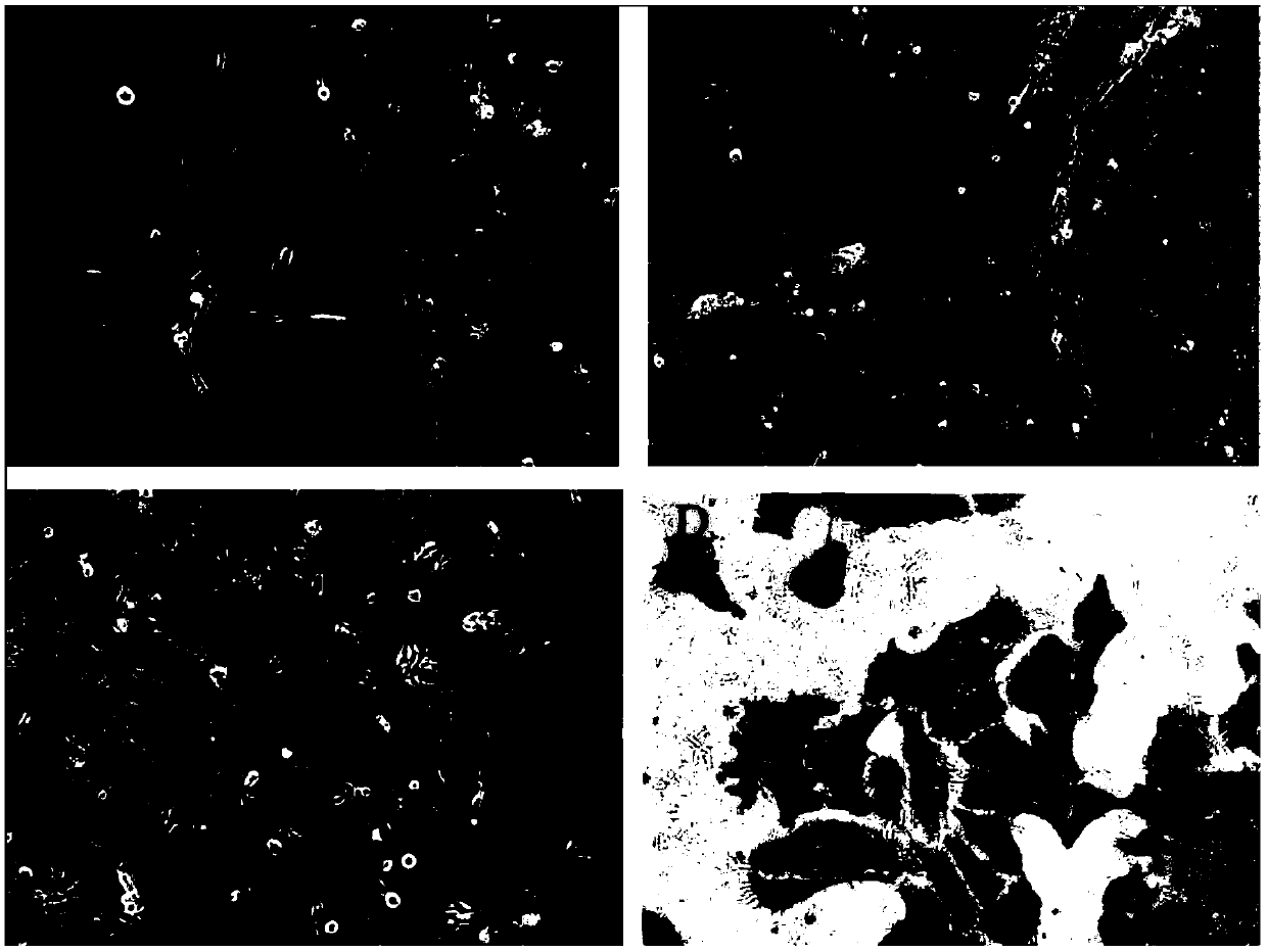SKH-1 mouse skin squamous carcinoma cell line and application thereof in preparation of transplanted tumor model