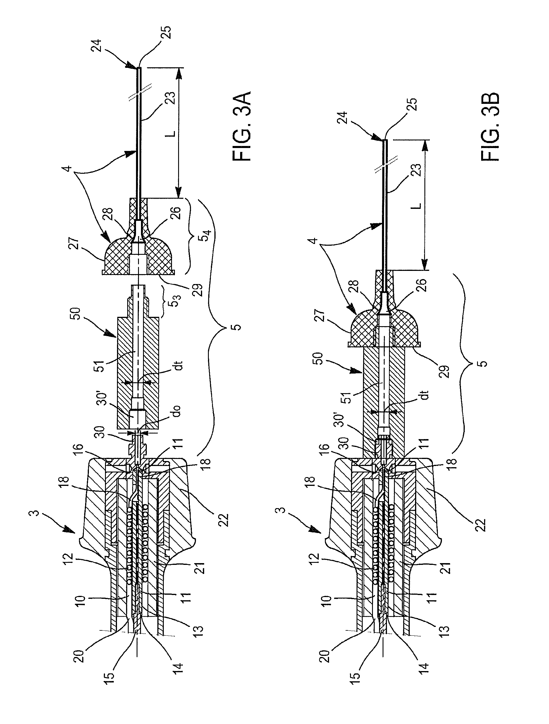 Device and Method for Injecting Pulsed Steam Into a Human or Animal Vessel E.G. a Vein