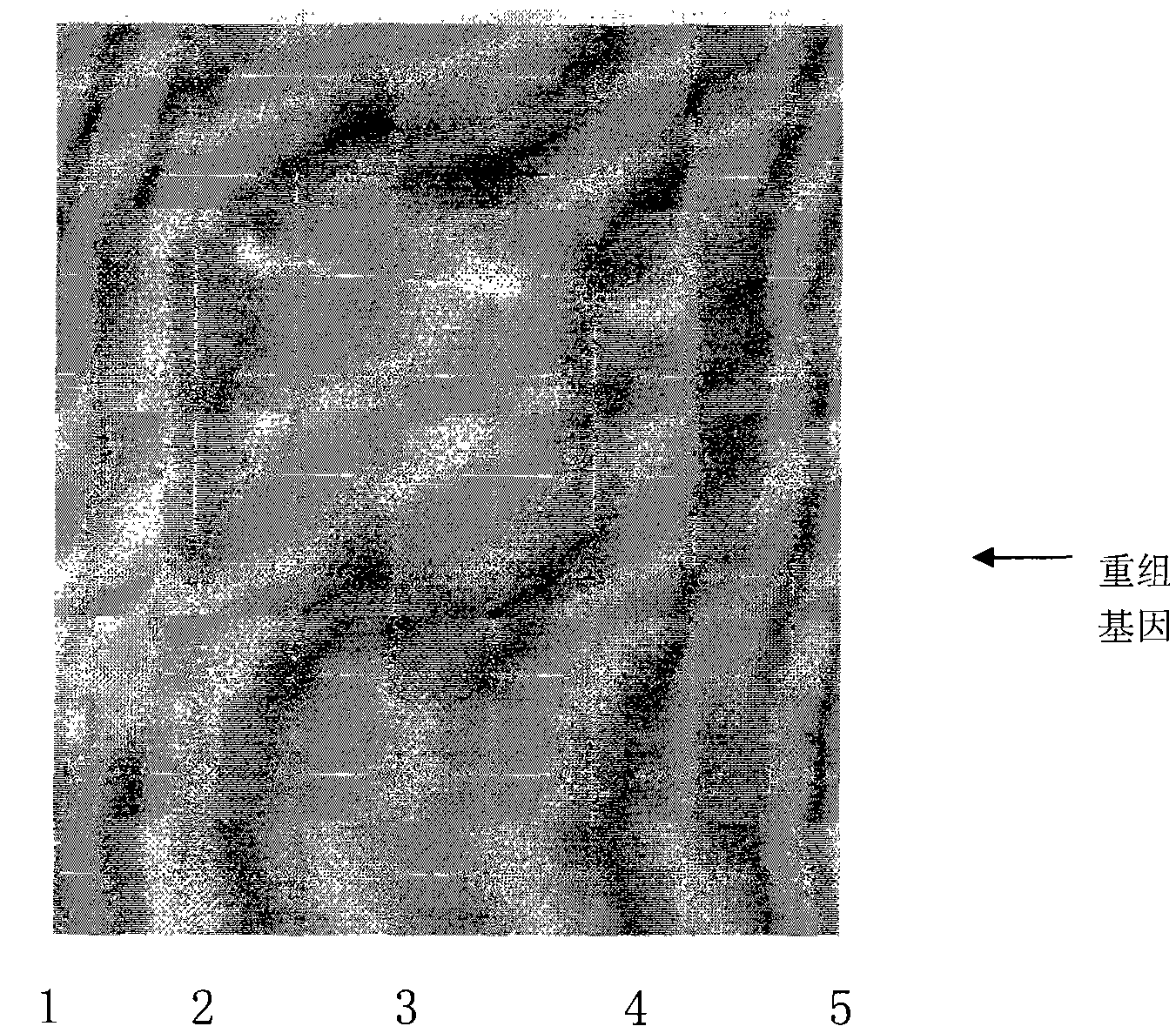 Recombinant rubella virus E1 protein and uses thereof