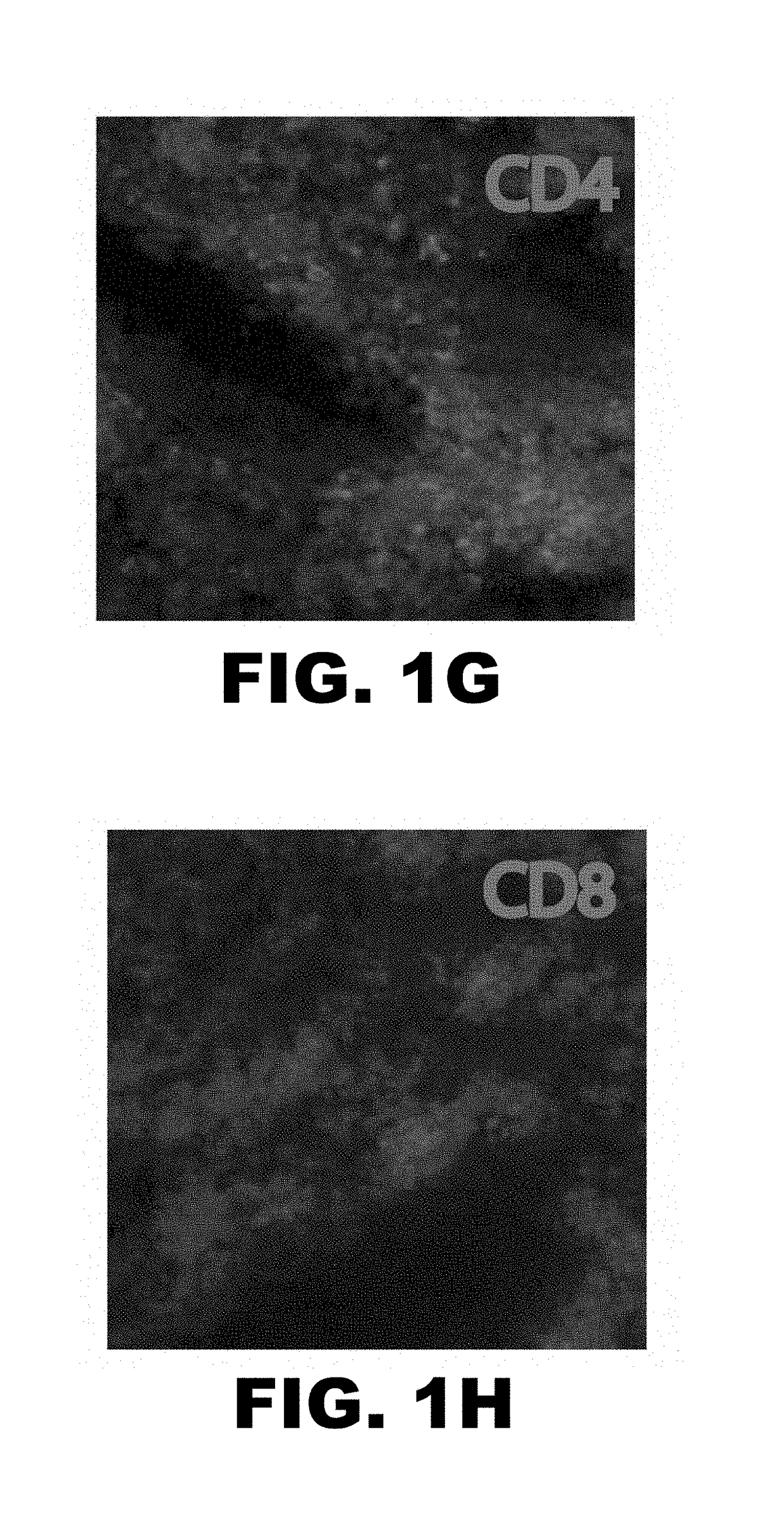 Induction of tolerance in lung allograft transplantation