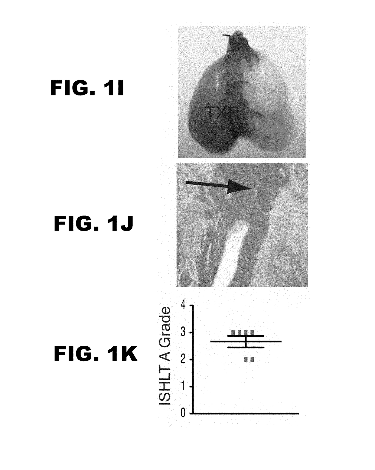 Induction of tolerance in lung allograft transplantation