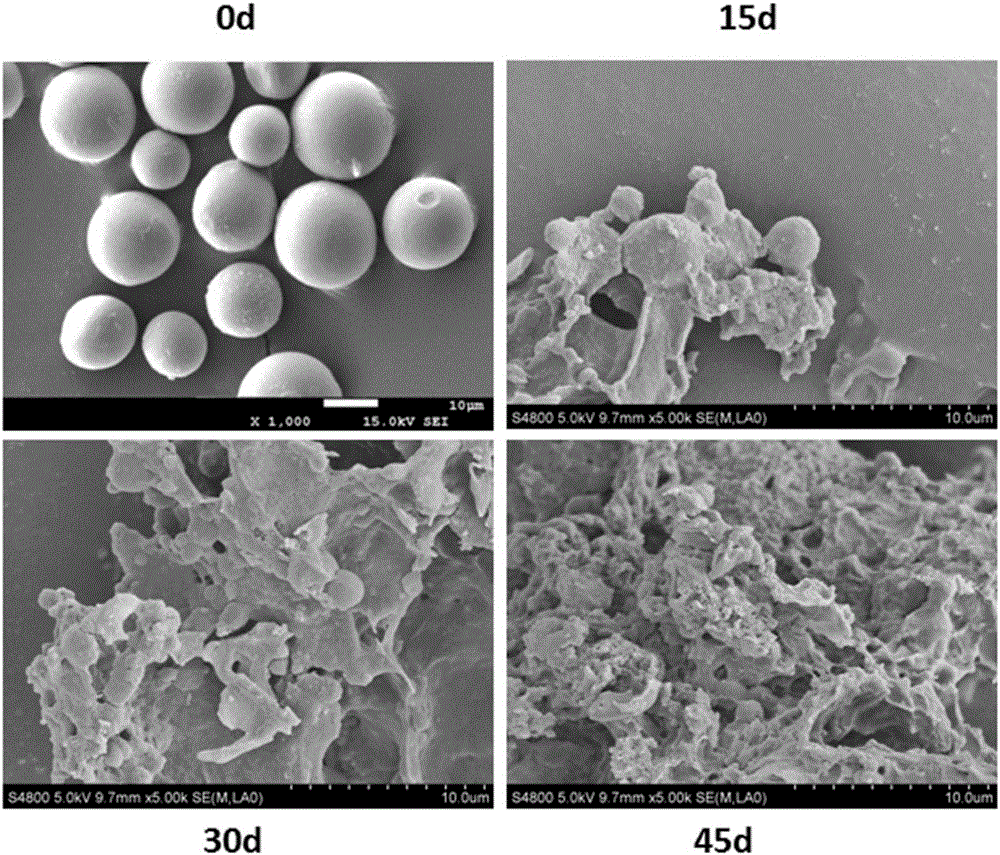 Preparation method and application of radioiodinated biodegradable chitosan-collagen composite microsphere medicine