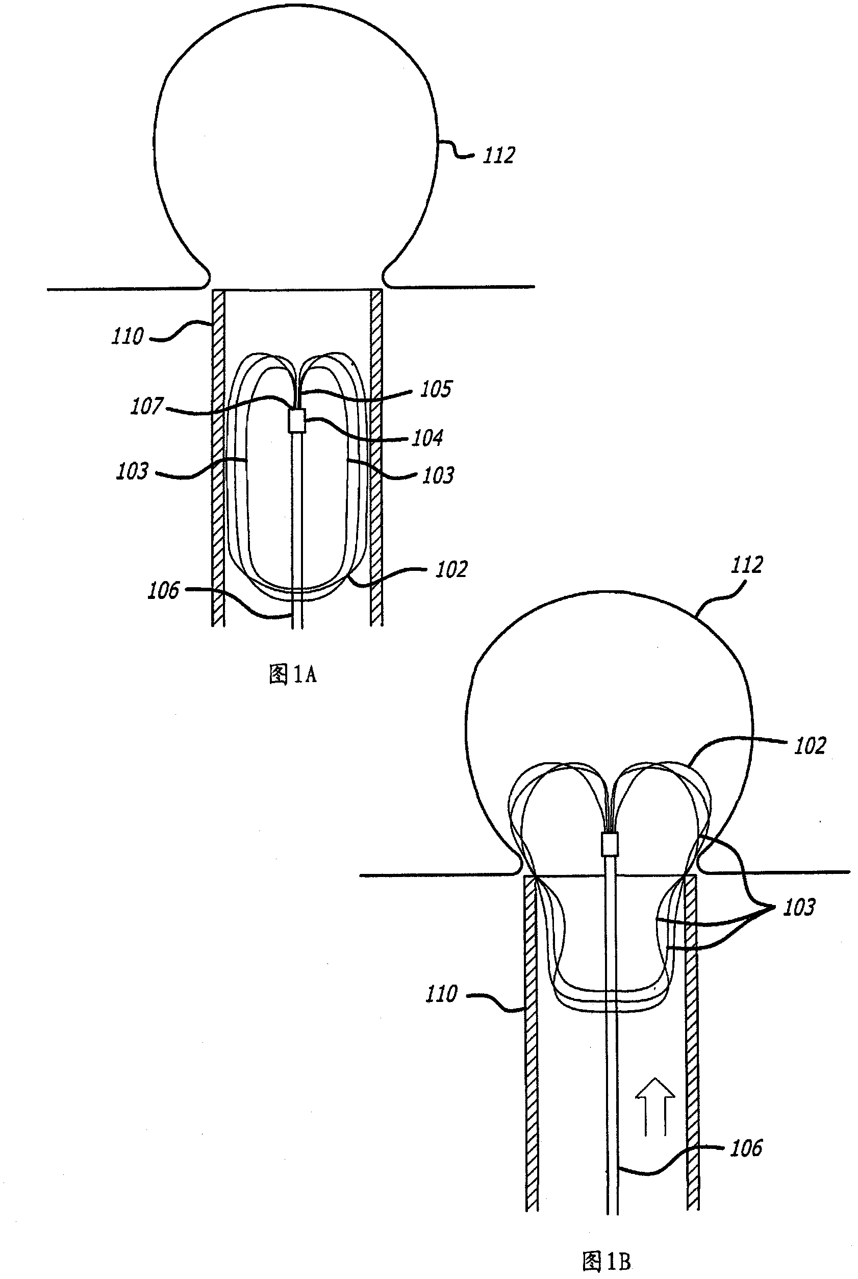 Self-expandable aneurysm filling device and system