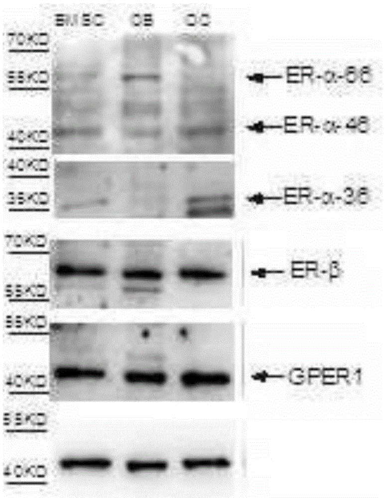 Application of cnidium lactone as [alpha]36 estrogen receptor activator