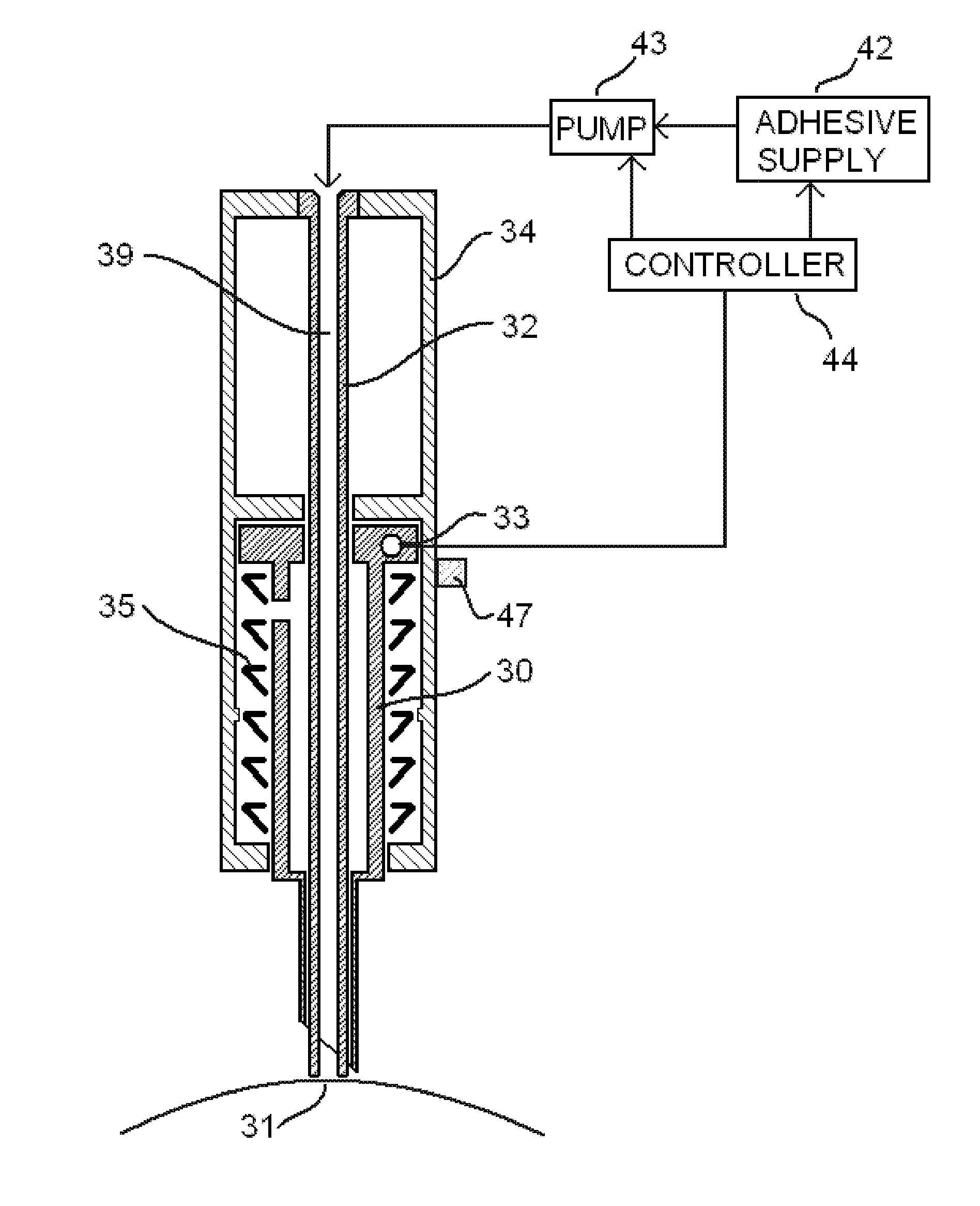 Hair implant apparatus and method for its use