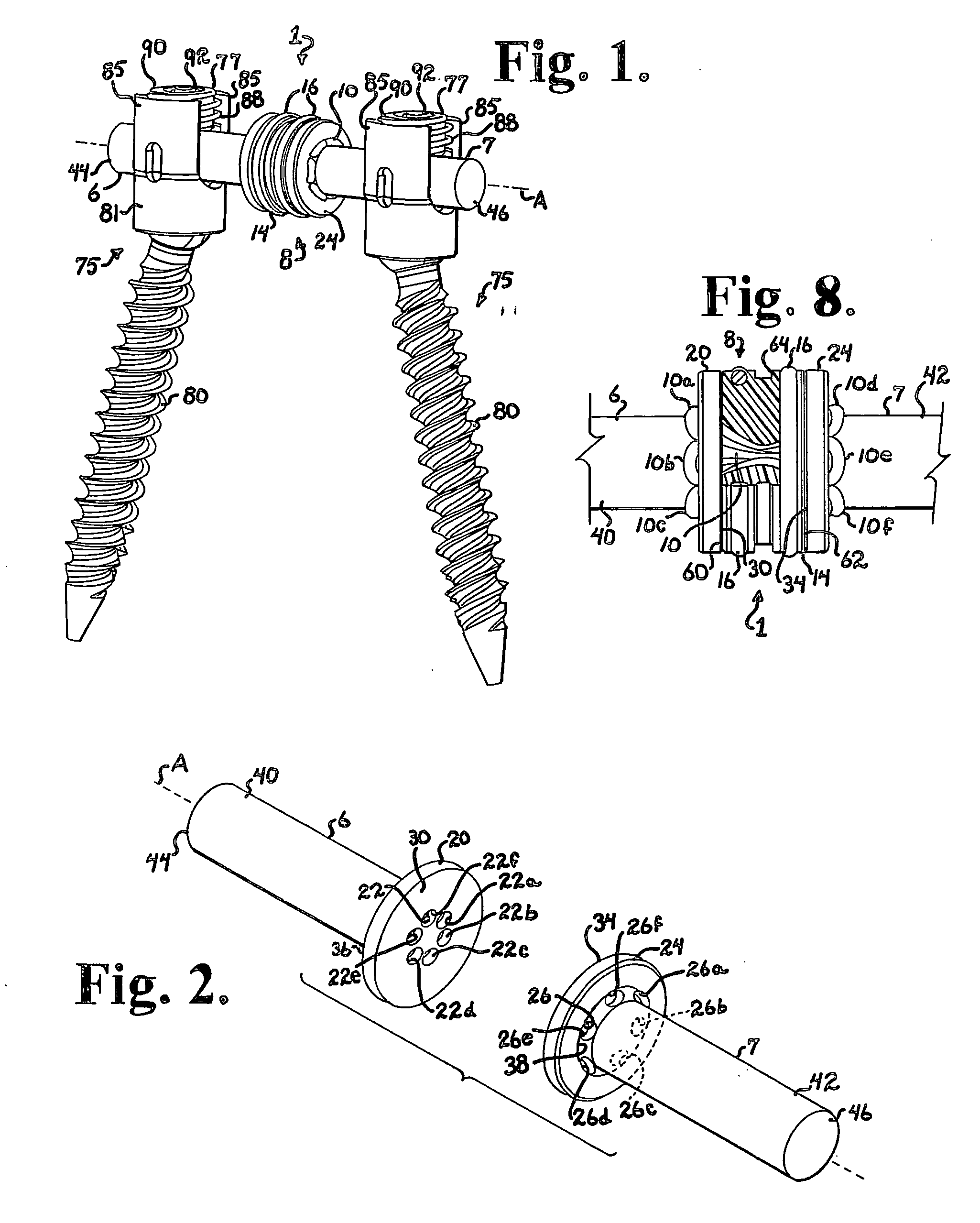 Soft stabilization assemblies with pretensioned cords
