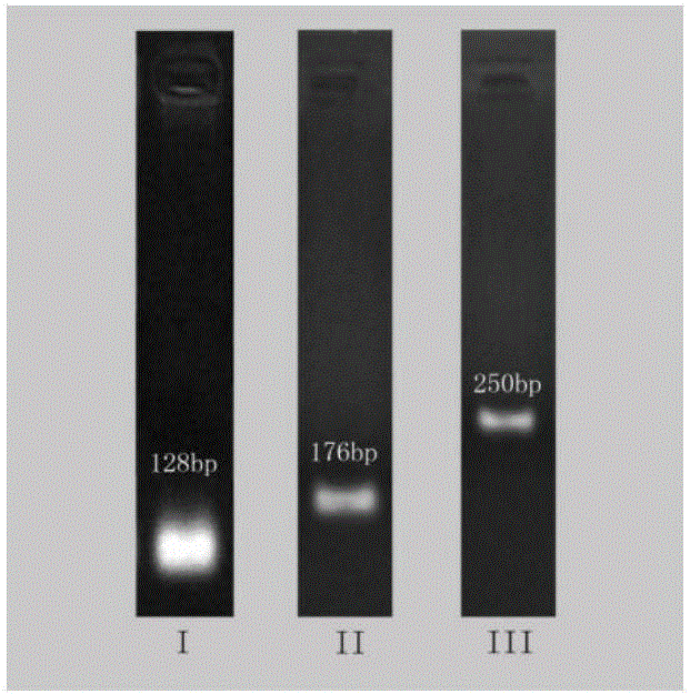 A kind of method for extracting total RNA from intermuscular bone of Dory