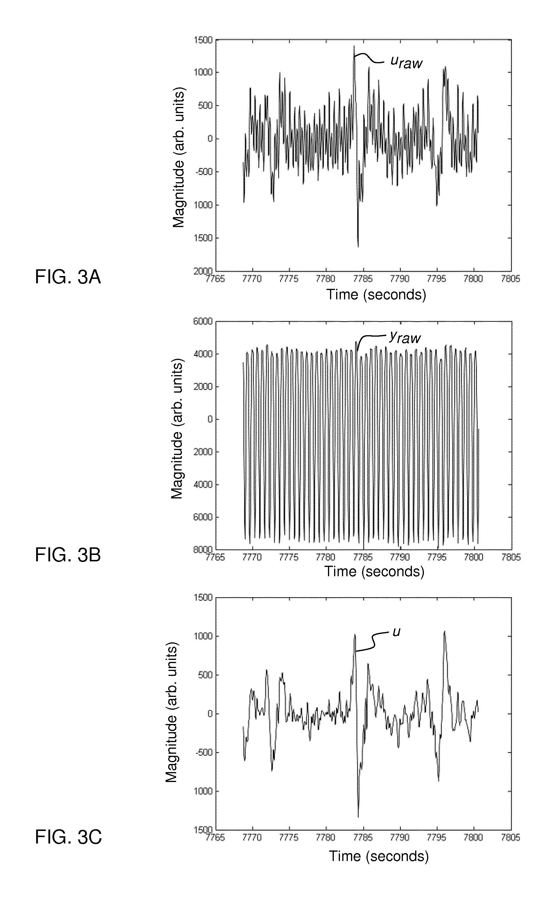 Detecting pressure pulses in a blood processing apparatus