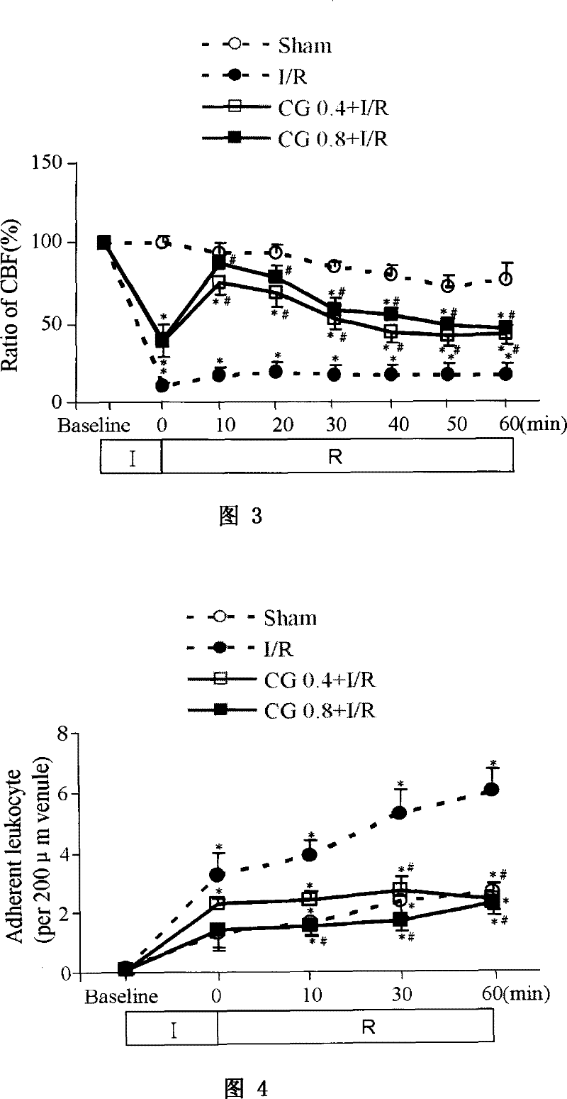 Uses of medicament composition in preparing medicament for improving brain microcirculation disorder