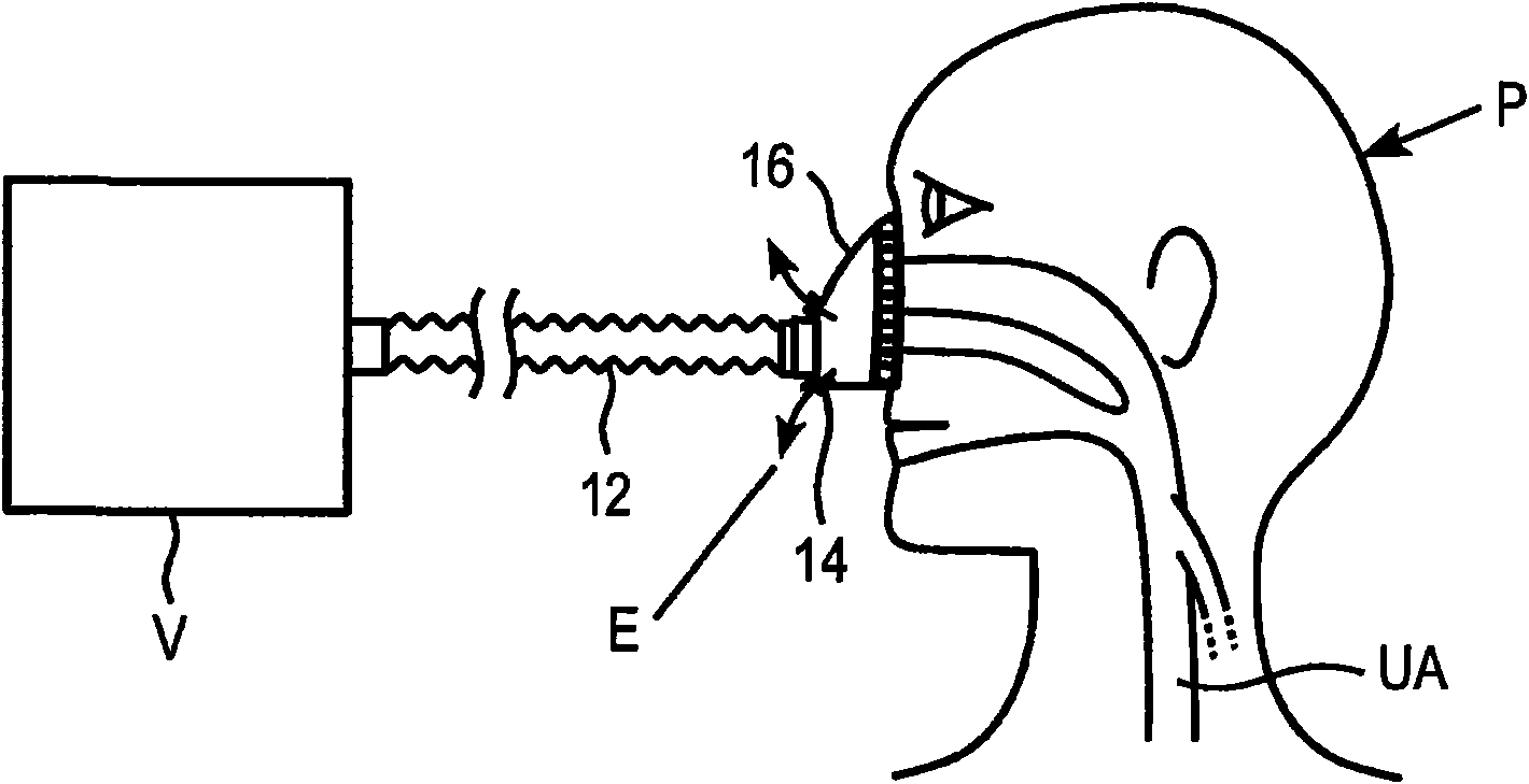 Methods and devices for providing inspiratory and expiratory flow relief during ventilation therapy