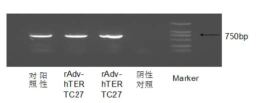 Preparation of gene immunization treating tumor used for vein