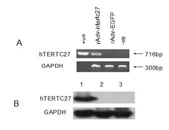 Preparation of gene immunization treating tumor used for vein