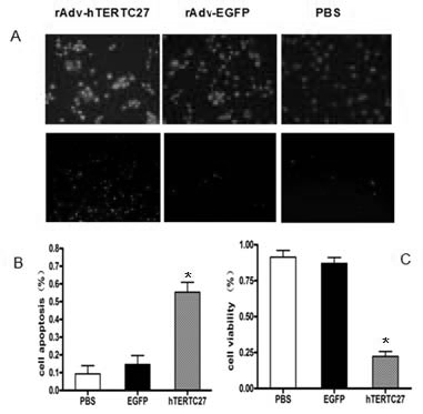 Preparation of gene immunization treating tumor used for vein