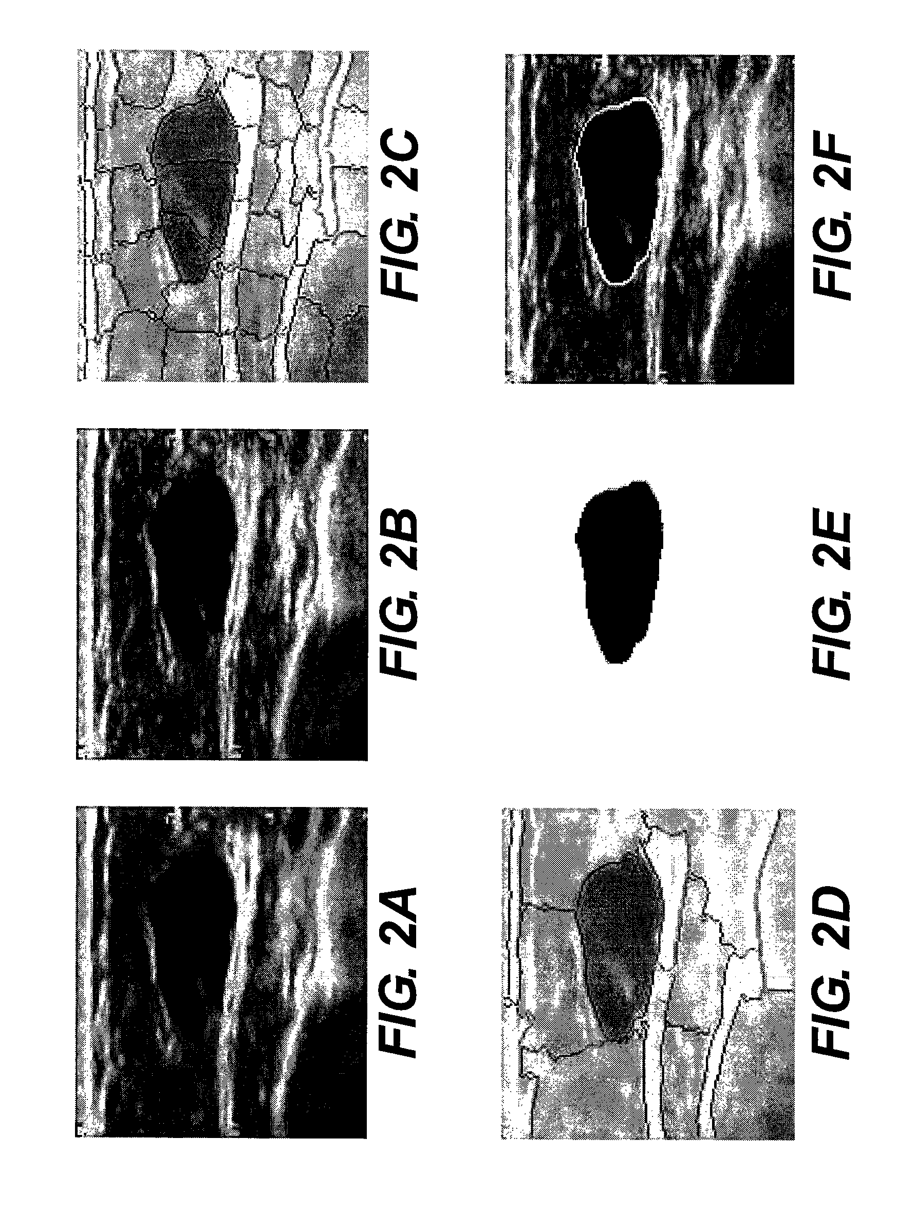 Segmentation of lesions in ultrasound images