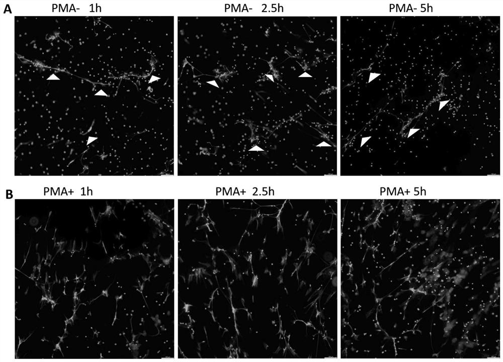 Improved neutrophil NETs immunofluorescence detection method