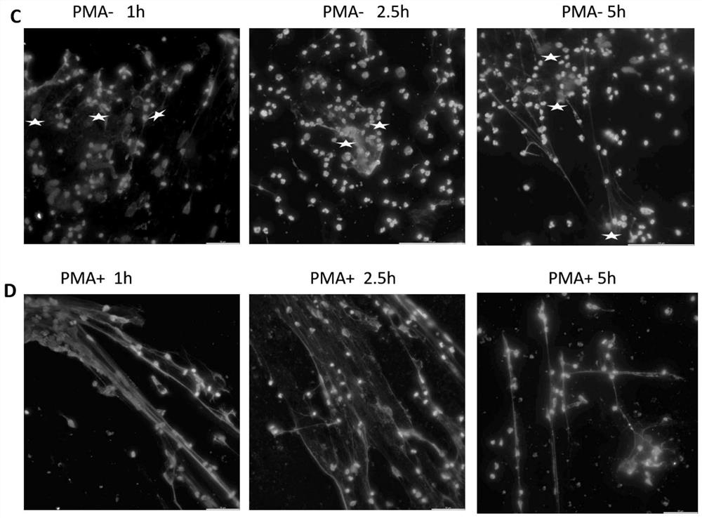 Improved neutrophil NETs immunofluorescence detection method