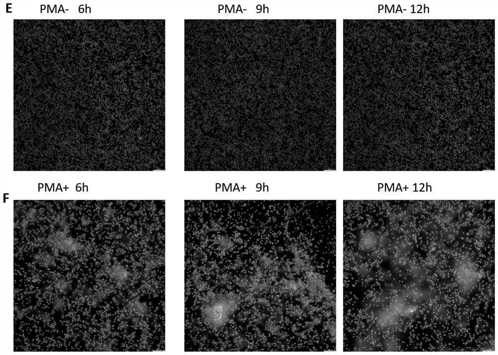 Improved neutrophil NETs immunofluorescence detection method