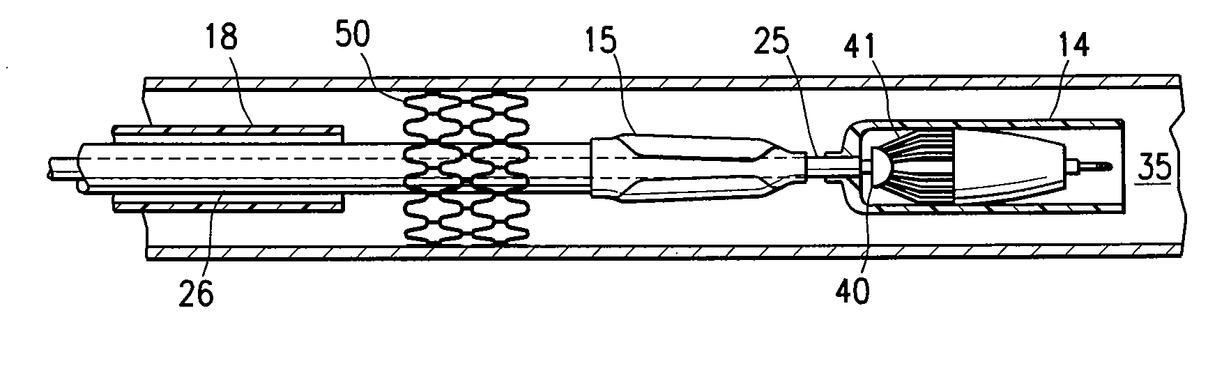Balloon catheter having a regrooming sheath and method for collapsing an expanded medical device