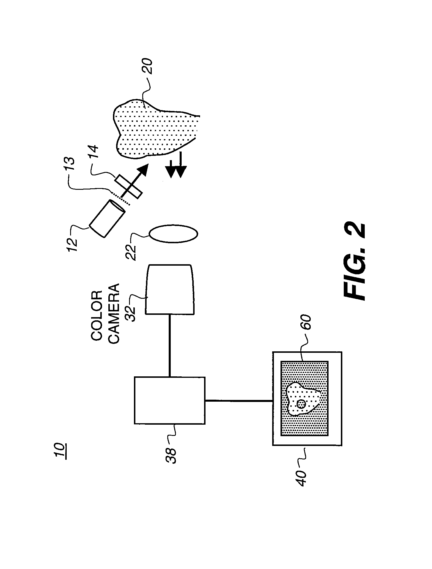 Apparatus for caries detection
