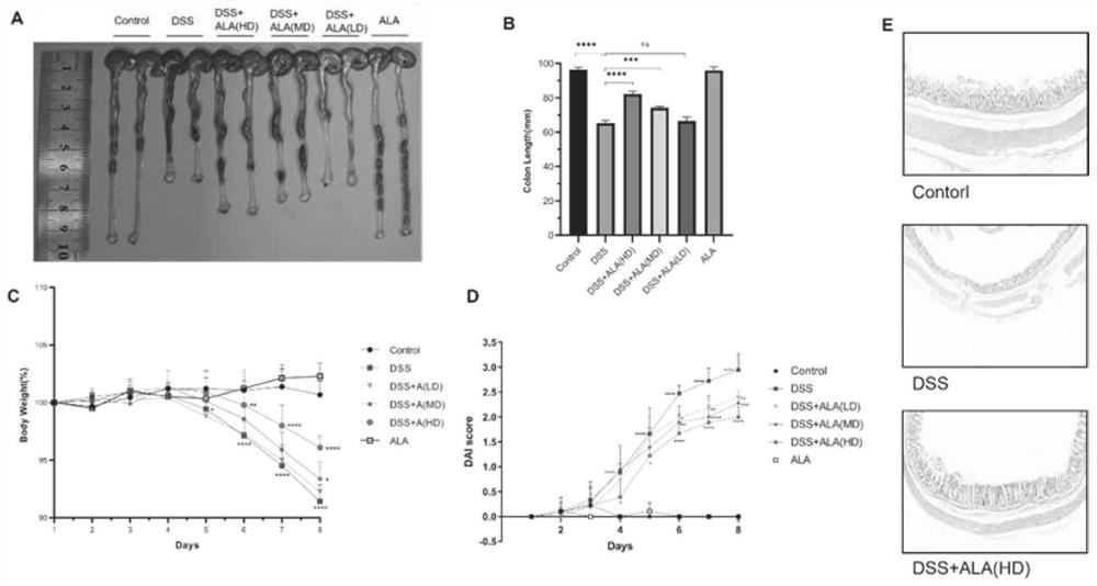 Application of 5-aminolevulinic acid in preparation of product for preventing and treating inflammatory bowel disease