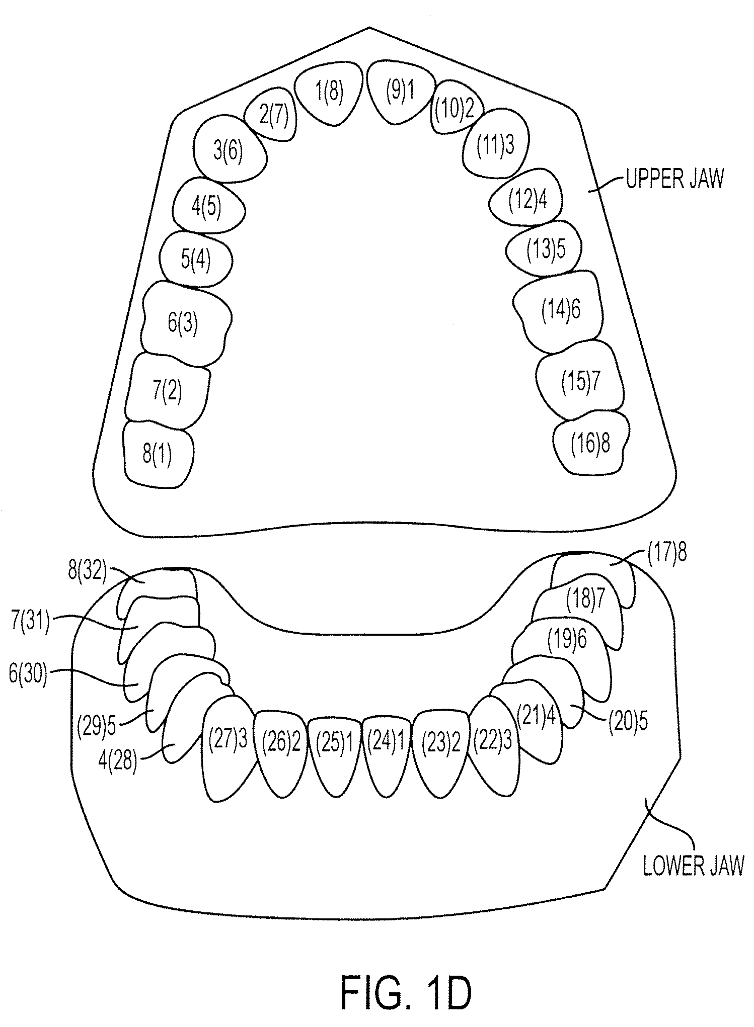 Automated treatment staging for teeth