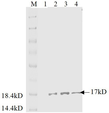 Latex enhanced turbidimetry detection kit for hepcidin prepared on basis of monoclonal antibody