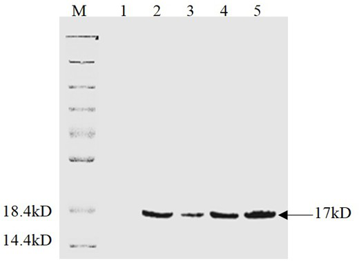 Latex enhanced turbidimetry detection kit for hepcidin prepared on basis of monoclonal antibody