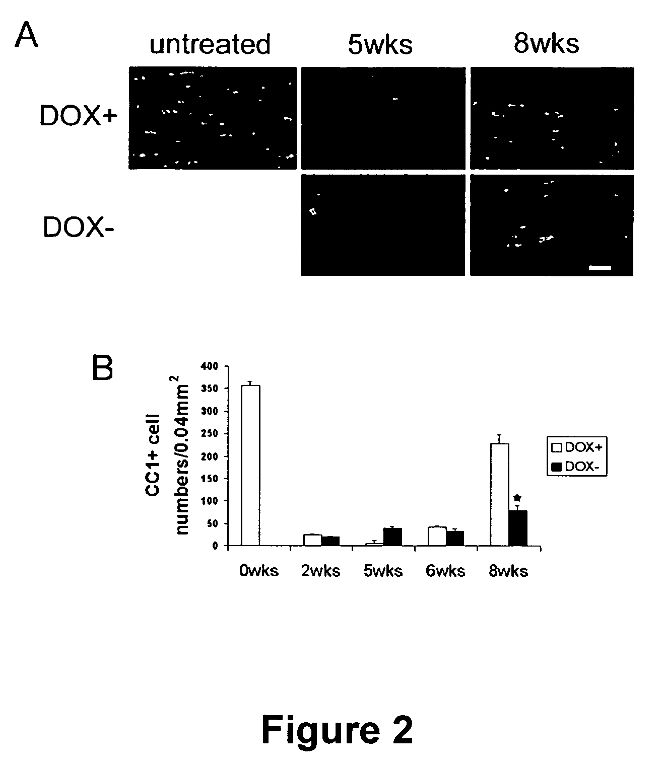 Cell-based screen for agents useful for reducing neuronal demyelination or promoting neuronal remyelination