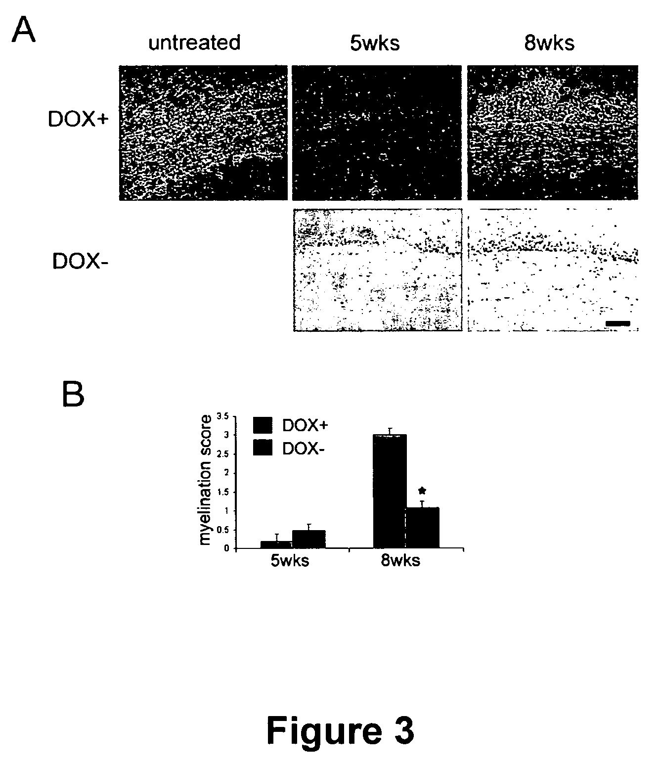 Cell-based screen for agents useful for reducing neuronal demyelination or promoting neuronal remyelination